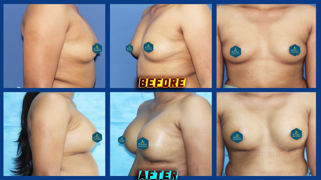 Before and After Procedure Results