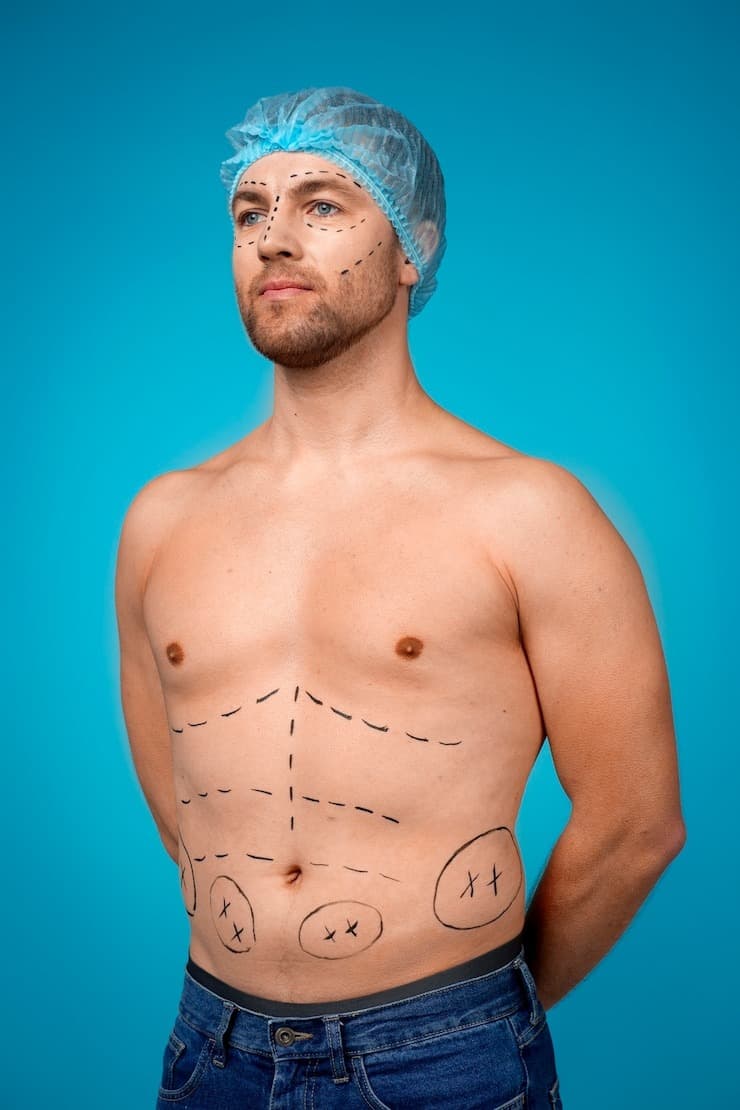 High-Definition Liposuction at Personiks: Facts You Need to Know
