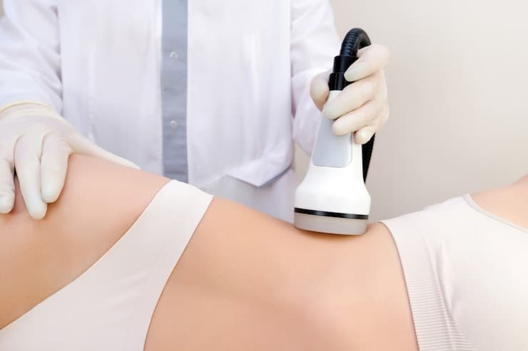 Laser Liposuction: The Future of Fat Reduction