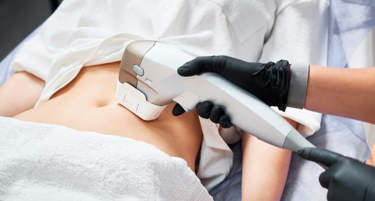 Laser Liposuction vs Standard Liposuction: Which is Better?