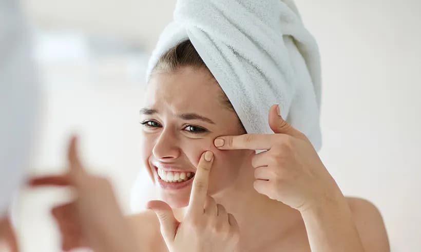 Acne Scar Treatment in Manikonda - Advanced Solutions for Clear, Smooth Skin