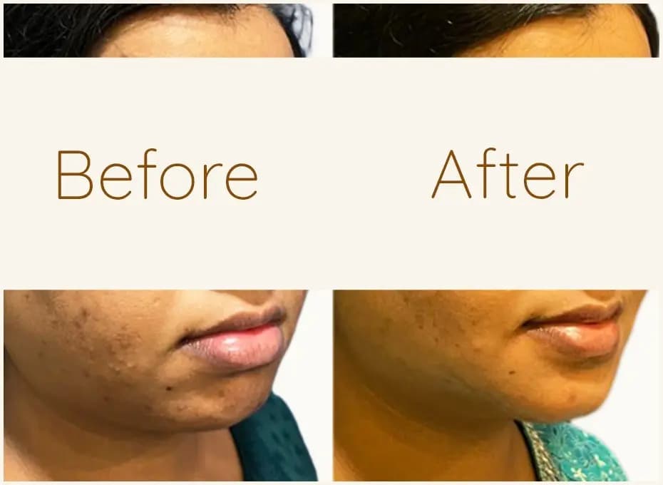 Before and After Procedure Results