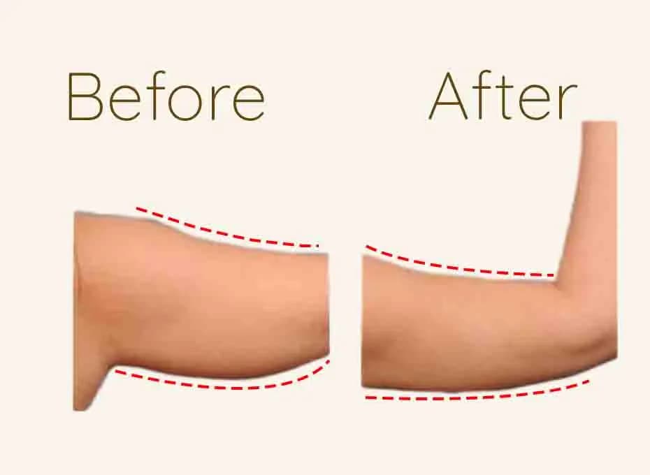 Before and After Procedure Results