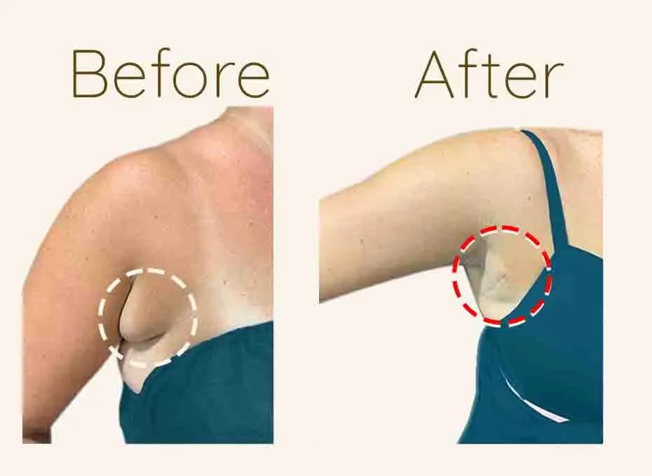 Before and After Procedure Results