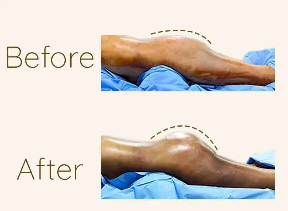 Before and After Procedure Results