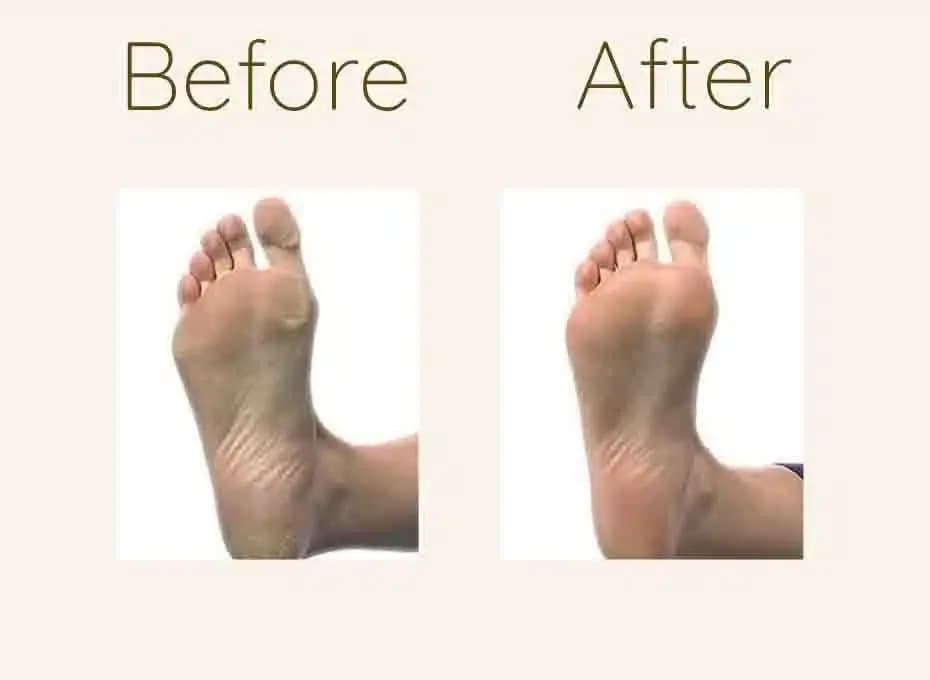 Before and After Procedure Results
