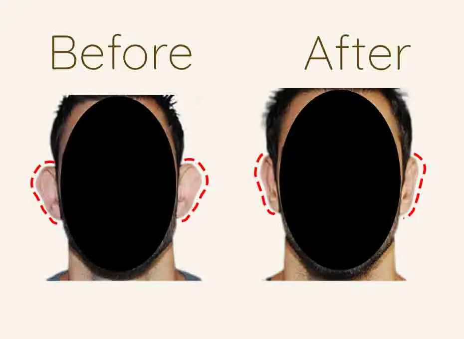 Before and After Procedure Results