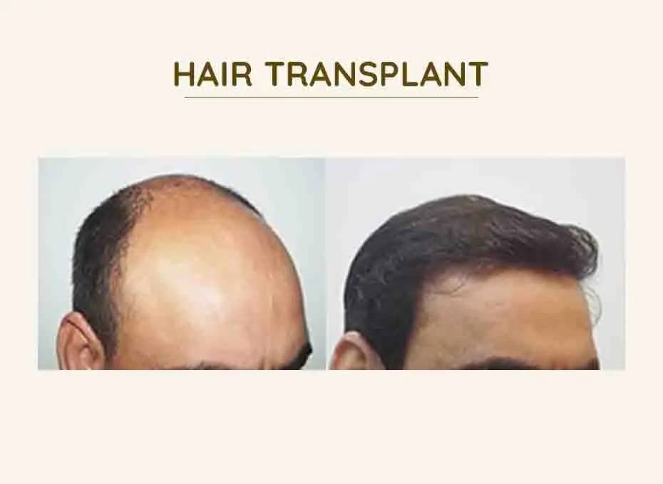 Before and After Procedure Results