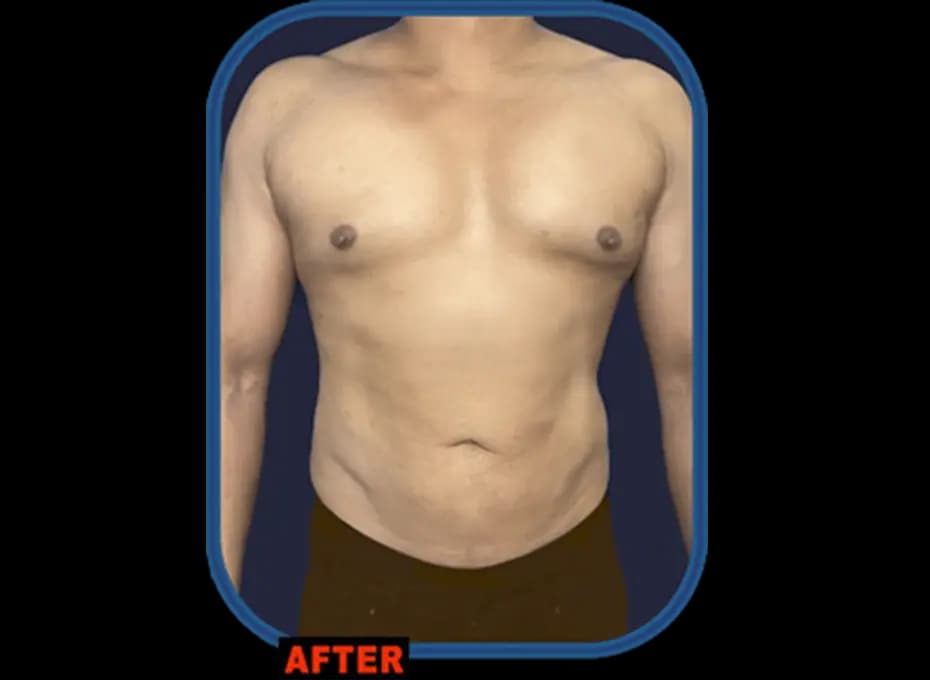 Before and After Procedure Results