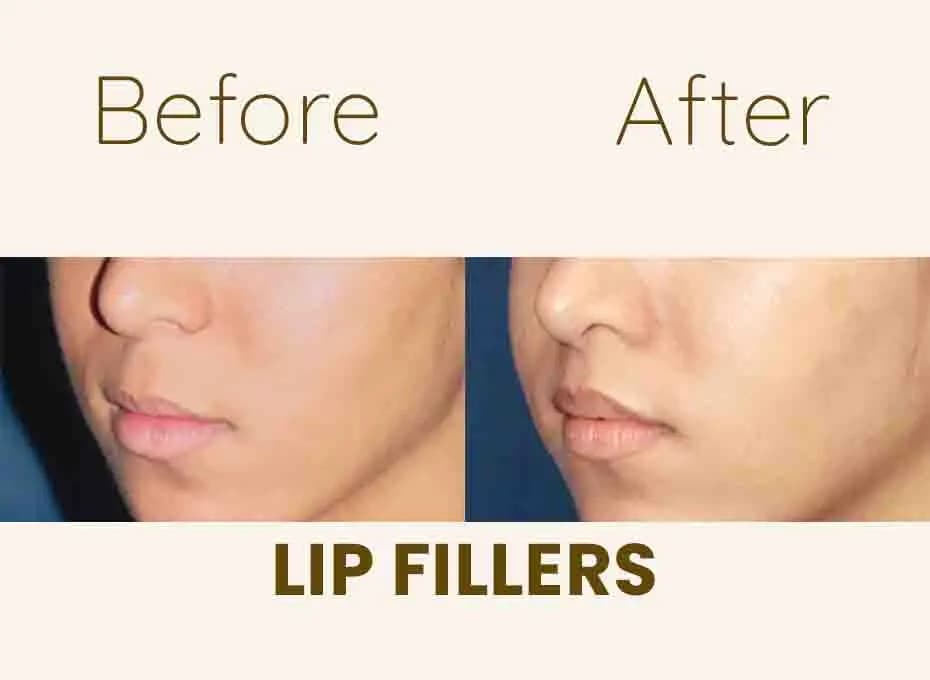 Before and After Procedure Results