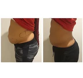 Before and After Results 1