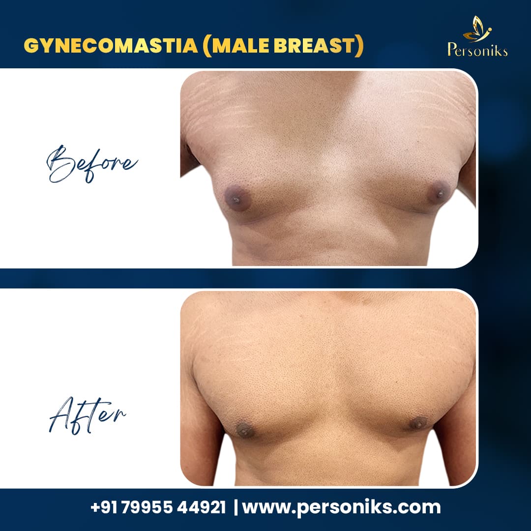 Before and After Results 1