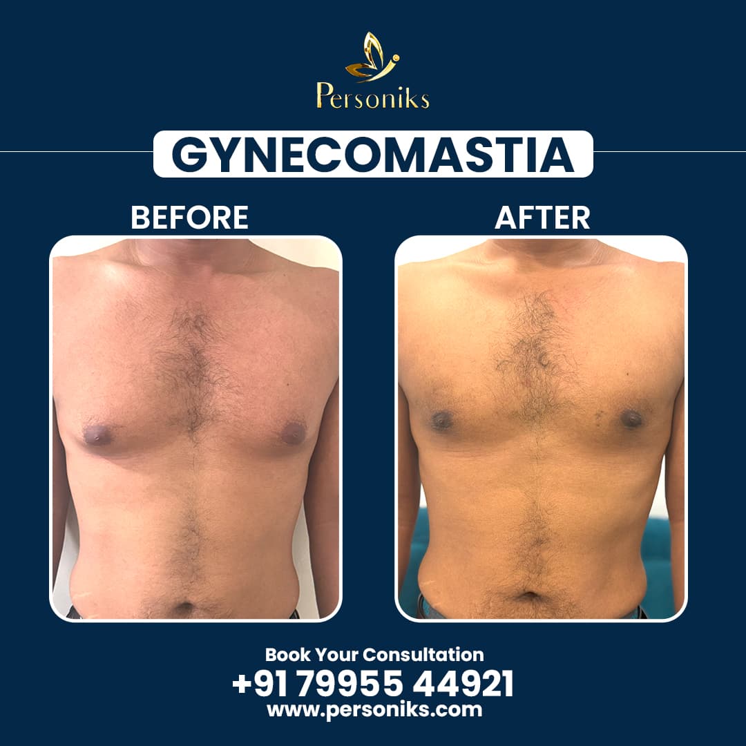 Before and After Results 2