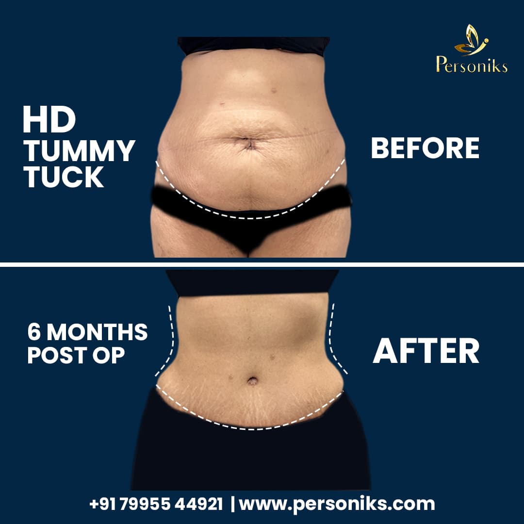 Before and After Results 1