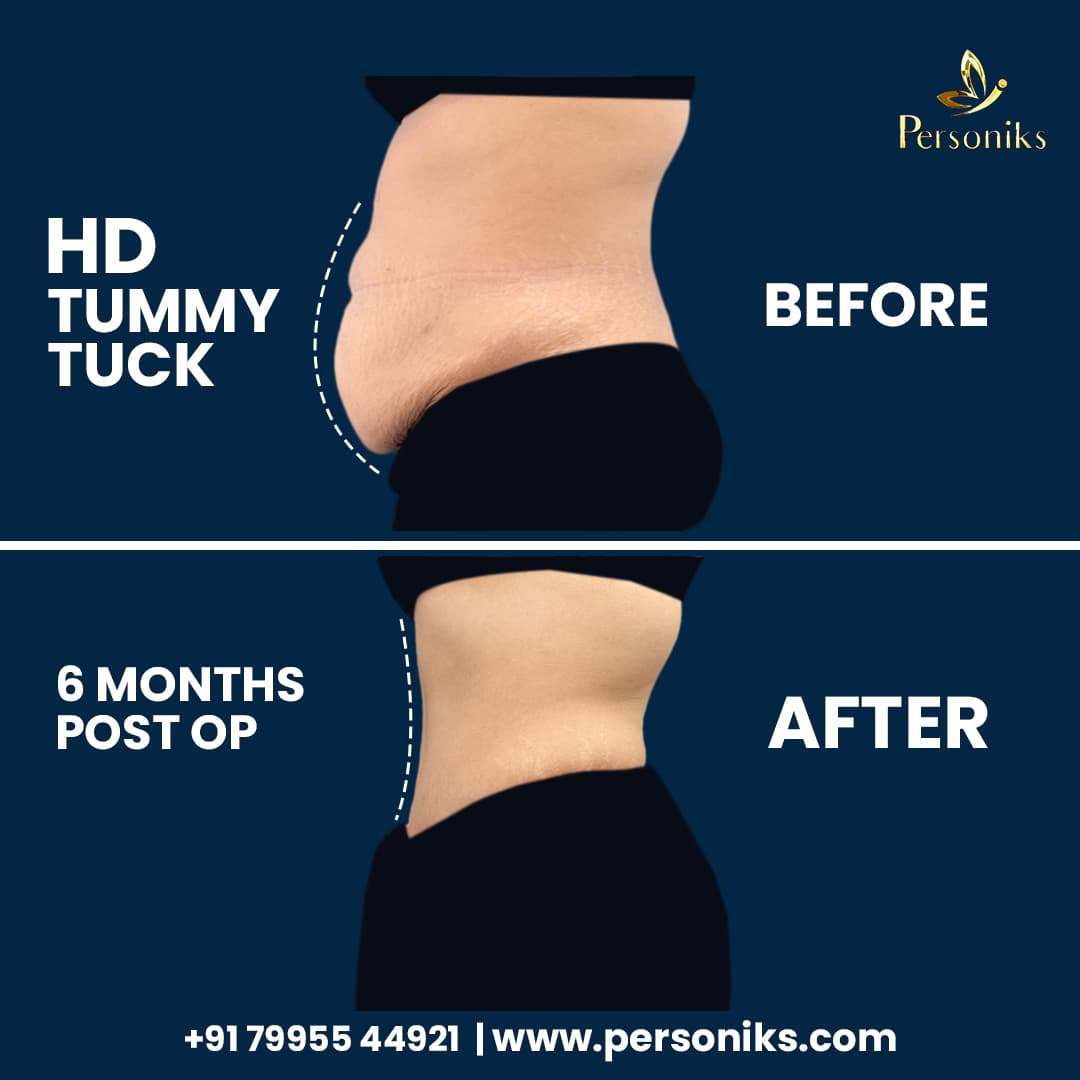 Before and After Results 2