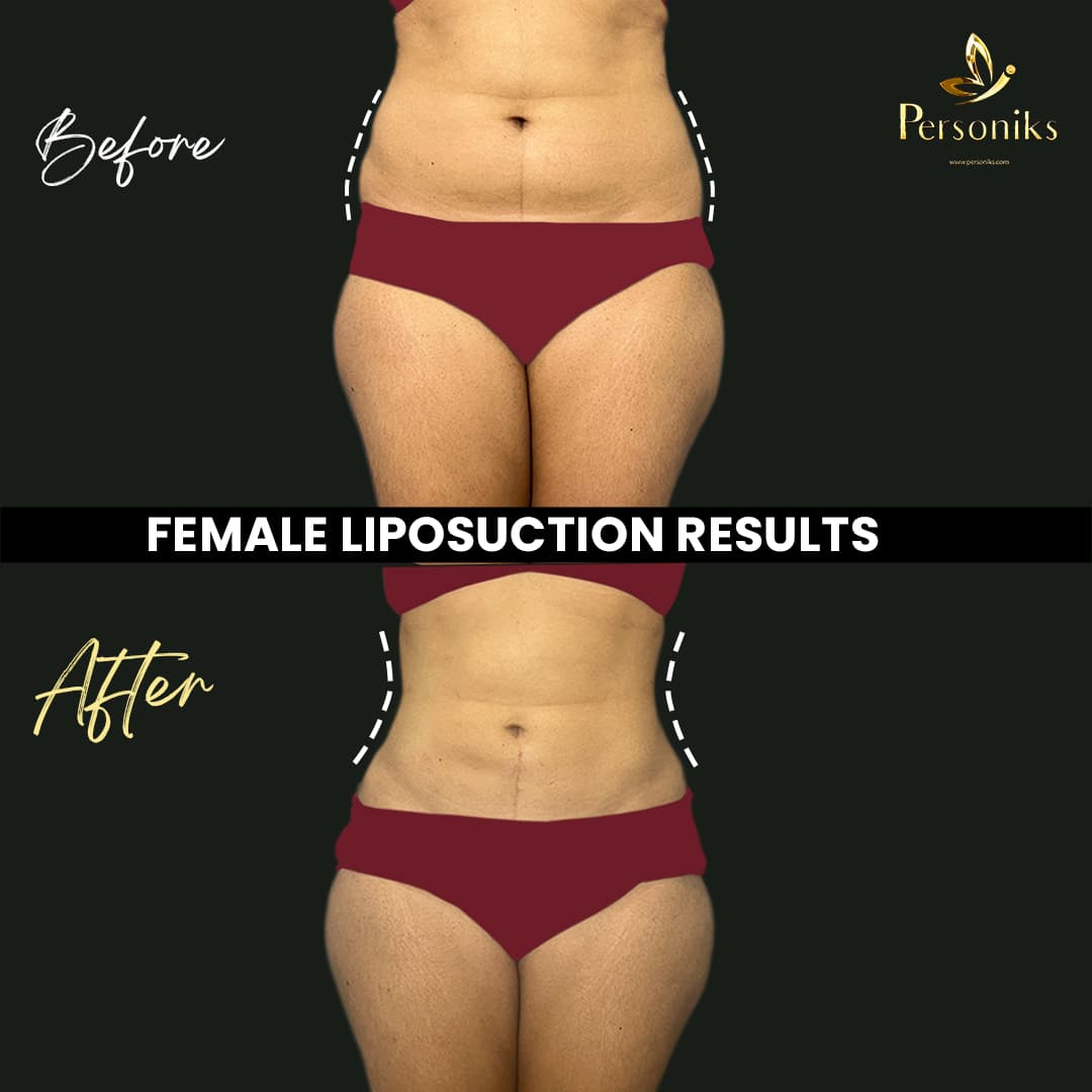 Before and After Results 2