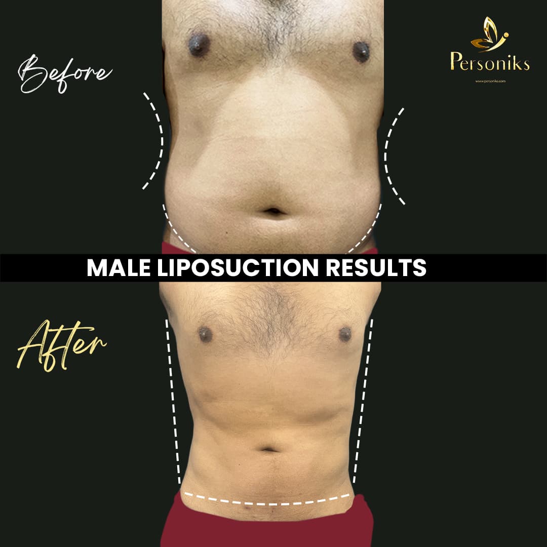 Before and After Results 1