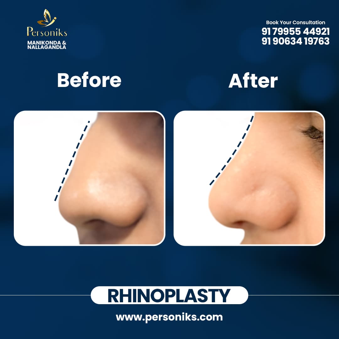 Before and After Results 2