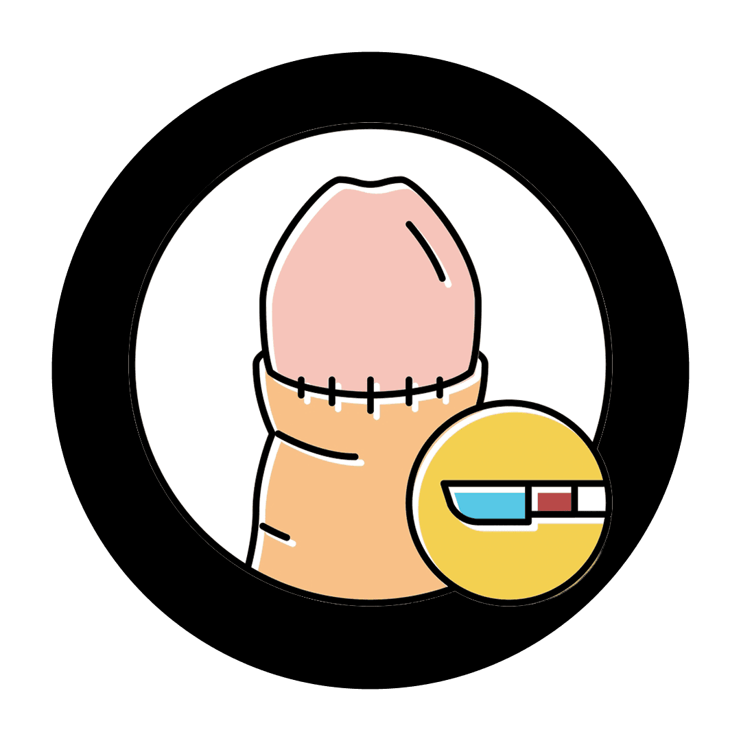 Circumcision